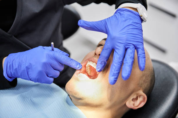 Best Knocked-Out Tooth (Avulsed Tooth) Treatment in Centerport, NY