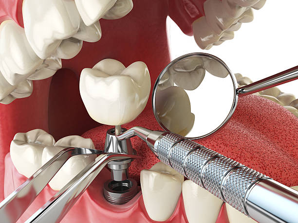 Best Emergency Treatment for Oral Infections in Centerport, NY